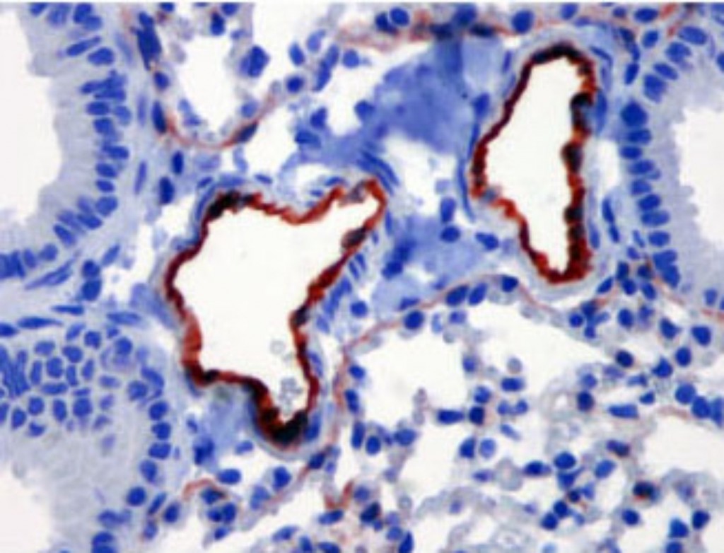 Immunostaining of GCaMP2 using an antibody against GFP