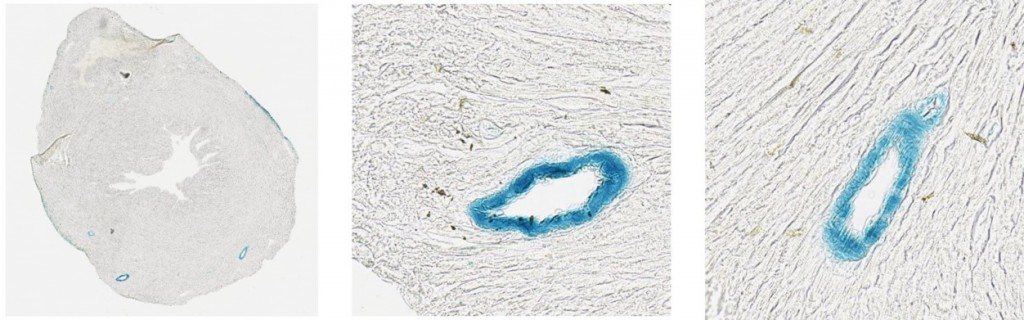 lacZ staining of smooth muscle cells in the heart (line 6)