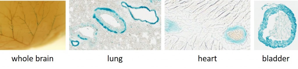 Acta2-CatCh-IRES-lacZ, line 3: lacZ staining of smooth muscle in whole or frozen tissue.