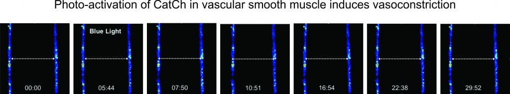 Vasoconstriction of vascular smooth muscle following photo-activation of CatCh.